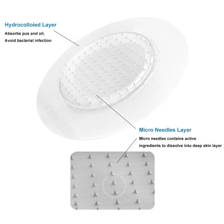 Pimple Patches Dissolving Microneedle Acne Treatment Pimple Acne Patches For Hormonal Acne And Blemishes Zit Patches